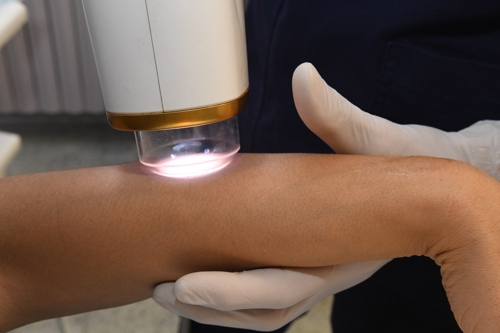 videodermatoscopia digitale dermatologia oncologica monza brianza