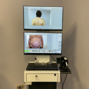 Mappatura Nevi Videodermatoscopia